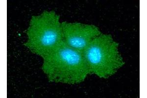 ICC/IF analysis of SAR1B in Hep3B cells line, stained with DAPI (Blue) for nucleus staining and monoclonal anti-human SAR1B antibody (1:100) with goat anti-mouse IgG-Alexa fluor 488 conjugate (Green).