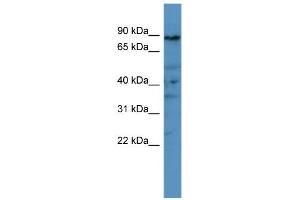 WB Suggested Anti-PDE8A Antibody Titration: 0. (PDE8A 抗体  (C-Term))