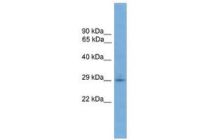 TMEM139 antibody used at 1 ug/ml to detect target protein. (TMEM139 抗体  (N-Term))