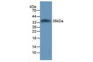 Western Blotting (WB) image for anti-Transmembrane Protein with EGF-Like and Two Follistatin-Like Domains 2 (TMEFF2) (AA 52-290) antibody (ABIN7442291)