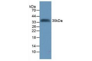 Detection of Recombinant Tomoregulin, Human using Polyclonal Antibody to Tomoregulin (TR) (TMEFF2 抗体  (AA 52-290))