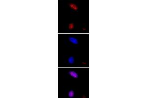Histone H3K27me3 pAb tested by immunofluorescence. (Histone 3 抗体  (3meLys27))