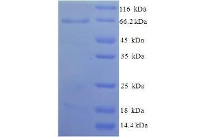 SDS-PAGE (SDS) image for Natriuretic Peptide Receptor A/guanylate Cyclase A (Atrionatriuretic Peptide Receptor A) (NPR1) (AA 33-473), (Extracellular) protein (His-SUMO Tag) (ABIN5710023)