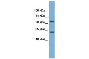 Western Blot showing PI4KB antibody used at a concentration of 1-2 ug/ml to detect its target protein.