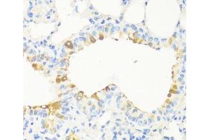Immunohistochemistry of paraffin-embedded Mouse bronchus using MAPRE3 Polyclonal Antibody at dilution of 1:100 (40x lens). (MAPRE3 抗体)