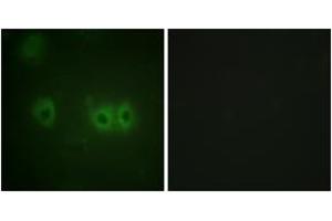 Immunofluorescence analysis of HuvEc cells, using MRLC2 (Ab-18) Antibody. (MYL12B 抗体  (AA 3-52))
