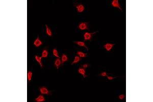 ABIN6266820 staining Hela by IF/ICC. (MAST3 抗体  (Internal Region))
