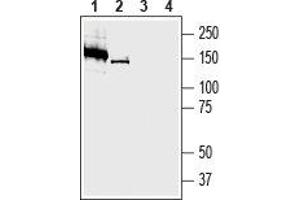 Western Blotting (WB) image for anti-Solute Carrier Family 23 (Nucleobase Transporters), Member 2 (SLC23A2) (AA 191-204), (Extracellular) antibody (ABIN7043705)
