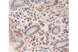 IHC-P analysis of Kidney tissue, with DAB staining. (DNAJC2 抗体  (AA 442-621))