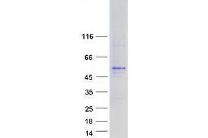 Western Blotting (WB) image for Aspartate beta-Hydroxylase (ASPH) (Transcript Variant 11) protein (Myc-DYKDDDDK Tag) (ABIN2715002)