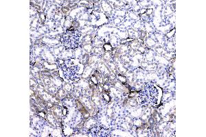 IHC analysis of CD44 using anti-CD44 antibody . (CD44 抗体  (AA 21-259))