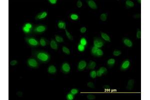 Immunofluorescence of monoclonal antibody to ZNF21 on HeLa cell. (ZNF182 抗体  (AA 81-190))