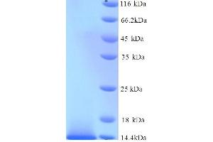 SDS-PAGE (SDS) image for Natriuretic Peptide Receptor B/guanylate Cyclase B (Atrionatriuretic Peptide Receptor B) (NPR2) (AA 37-112) protein (His tag) (ABIN5714314)