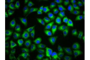 Immunofluorescence staining of Hela cells with ABIN7159233 at 1:133, counter-stained with DAPI. (MC1 Receptor 抗体  (AA 1-37))