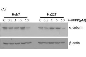 Western Blotting (WB) image for anti-Tubulin, alpha 1B (TUBA1B) antibody (ABIN2855283)