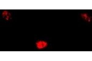 Immunofluorescent analysis of SIN3A staining in U2OS cells. (SIN3A 抗体)