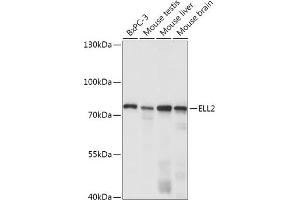 Western Blotting (WB) image for anti-Elongation Factor, RNA Polymerase II, 2 (ELL2) (AA 253-352) antibody (ABIN7266925)