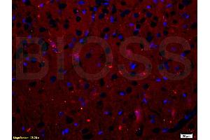 Formalin-fixed and paraffin embedded rat brain tissue labeled with Anti-RANK/CD265 Polyclonal Antibody, Unconjugated (ABIN749258) at 1:200 followed by conjugation to the secondary antibody, Goat Anti-Rabbit IgG, Cy3 conjugated, and DAPI staining (TNFRSF11A 抗体  (AA 51-150))
