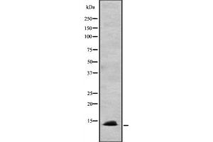 Western blot analysis of CCL24 expression in HEK293 cells ,The lane on the left is treated with the antigen-specific peptide. (CCL24 抗体  (C-Term))