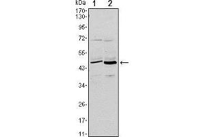 Western blot analysis using CD86 mouse mAb against L1210 (1) and MOLT-4 (2) cell lysate. (CD86 抗体)
