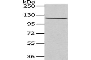 Gel: 6 % SDS-PAGE,Lysate: 40 μg,Primary antibody: ABIN7193040(WDR36 Antibody) at dilution 1/200 dilution,Secondary antibody: Goat anti rabbit IgG at 1/8000 dilution,Exposure time: 1 minute (WDR36 抗体)