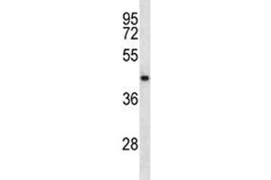 NDRG2 antibody western blot analysis in CEM lysate. (NDRG2 抗体  (AA 42-70))