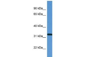 WB Suggested Anti-ZAP70 Antibody Titration: 1. (ZAP70 抗体  (N-Term))