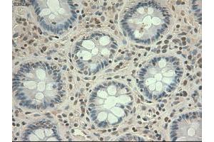 Image no. 17 for anti-Myc Proto-Oncogene protein (MYC) antibody (ABIN1497011) (c-MYC 抗体)