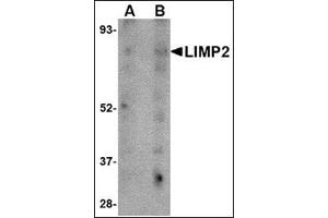 Western blot analysis of LIMP2 in human skeletal muscle tissue lysate with this product at (A) 1 and (B) 2 μg/ml. (SCARB2 抗体  (C-Term))
