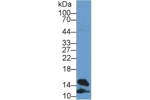 Detection of FABP4 in Rat Heart lysate using Polyclonal Antibody to Fatty Acid Binding Protein 4 (FABP4) (FABP4 抗体  (AA 2-132))