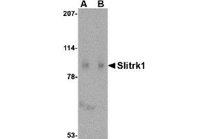 Western Blotting (WB) image for anti-SLIT and NTRK-Like Family, Member 1 (SLITRK1) (C-Term) antibody (ABIN1030680)