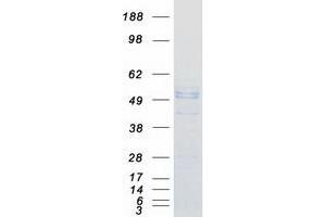 Validation with Western Blot