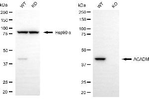 Western blotting analysis using ACADM antibody (ABIN7799352). (Recombinant Medium-Chain Specific Acyl-CoA Dehydrogenase, Mitochondrial (MCAD) 抗体)