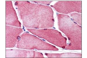 Human Skeletal Muscle: Formalin-Fixed, Paraffin-Embedded (FFPE) (TMEM38A 抗体  (C-Term))