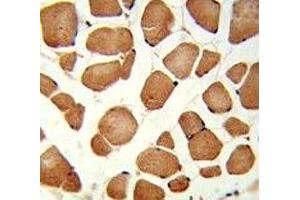 IHC analysis of FFPE human skeletal muscle stained with ANGPTL4 antibody (ANGPTL4 抗体  (AA 138-167))
