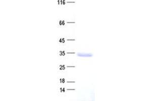 FBXO25 Protein (His tag)