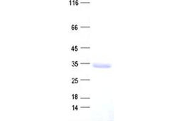FBXO25 Protein (His tag)