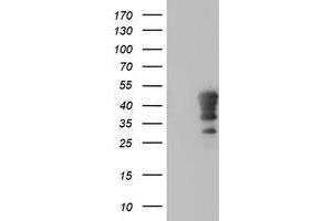 Western Blotting (WB) image for anti-Homeobox C11 (HOXC11) (AA 1-304) antibody (ABIN1490736) (HOXC11 抗体  (AA 1-304))