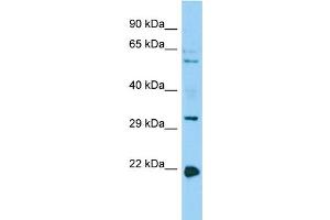 Host: Rabbit Target Name: CORO1B Sample Type: HepG2 Whole Cell lysates Antibody Dilution: 1. (CORO1B 抗体  (C-Term))