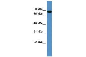 WB Suggested Anti-COL9A3 Antibody Titration: 0. (COL9A3 抗体  (C-Term))