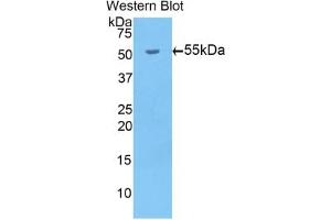 Detection of Recombinant bACE1, Mouse using Polyclonal Antibody to Beta-Site APP Cleaving Enzyme 1 (bACE1) (BACE1 抗体  (AA 190-430))