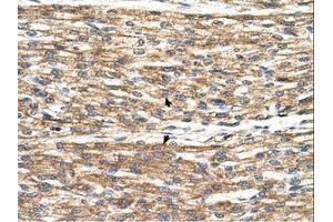 Image no. 1 for anti-Patatin-Like phospholipase Domain Containing 3 (PNPLA3) (C-Term) antibody (ABIN6738525) (PNPLA3 抗体  (C-Term))