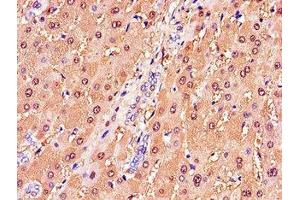 Immunohistochemistry of paraffin-embedded human liver tissue using ABIN7154085 at dilution of 1:100 (GSTA1 抗体  (AA 2-222))