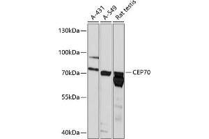 Western blot analysis of extracts of various cell lines, using CEP70 antibody (ABIN6129670, ABIN6138429, ABIN6138430 and ABIN6218042) at 1:3000 dilution. (CEP70 抗体  (AA 1-280))