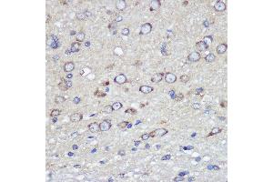 Immunohistochemistry (IHC) image for anti-F11 Receptor (F11R) (AA 30-238) antibody (ABIN3021823)