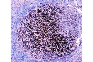 IHC-P: CD82 antibody testing of human tonsil tissue (CD82 抗体  (AA 98-267))