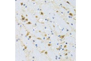 Immunohistochemistry of paraffin-embedded mouse brain using CCT4 antibody. (CCT4 抗体  (AA 130-390))