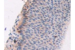 Immunohistochemistry (IHC) image for anti-Cat Eye Syndrome Chromosome Region, Candidate 1 (CECR1) (AA 30-511) antibody (ABIN7430045)