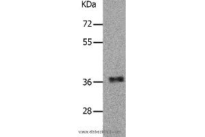 Western blot analysis of Human fetal muscle tissue, using PARD6A Polyclonal Antibody at dilution of 1:650 (PARD6A 抗体)