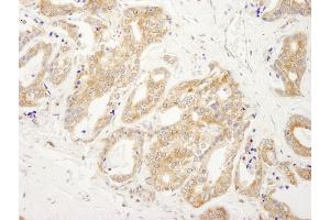 Immunohistochemistry (IHC) image for anti-DEAD (Asp-Glu-Ala-Asp) Box Polypeptide 6 (DDX6) (AA 1-50) antibody (ABIN7448524) (DDX6 抗体  (AA 1-50))